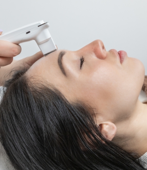 Gerät zur Hautanalyse an weiblicher Stirn symbolisiert Akne behandeln an der Elbklinik Hamburg