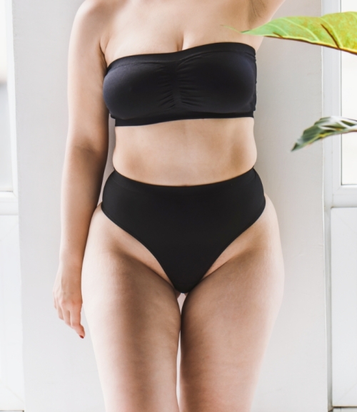 Unterkörper einer fülligeren Frau in Unterwäsche symbolisiert ganzheitlichen Ansatz der Lipödem-Behandlung in Hamburg