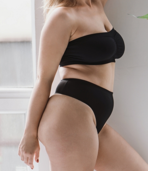 Unterkörper einer fülligeren Frau in Unterwäsche symbolisiert ganzheitliche Lipödem-Behandlung in Elbklinik